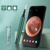 Wireless WiFi Ear Otoscope Oto Speculum Ultra-Thin Ear Scope Camera Waterproof Earwax Removal Tool