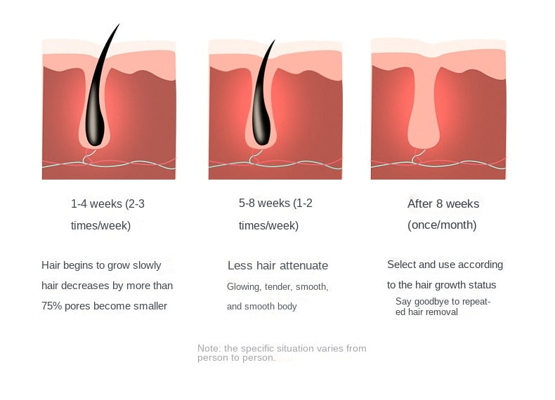 IPL laser hair removal epilator laser hair removal photoepilator machine hair remover depilation photo permanent Pulsed device